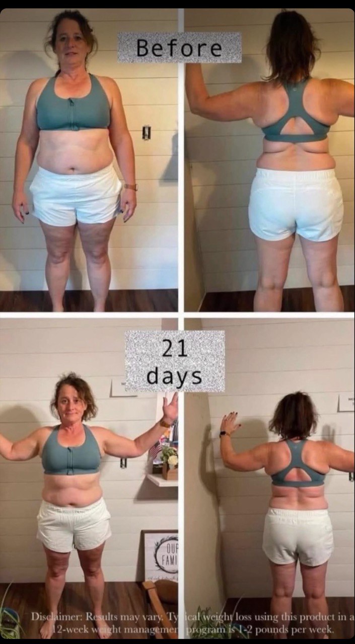 Before and after, front and back, over 21 days