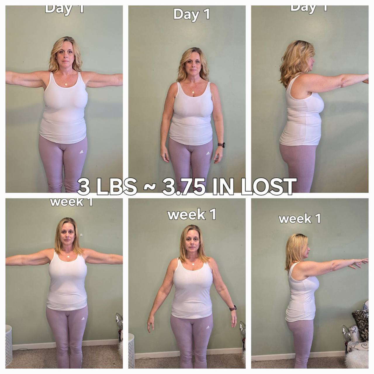 Day 1 versus week 1 front and side transformation