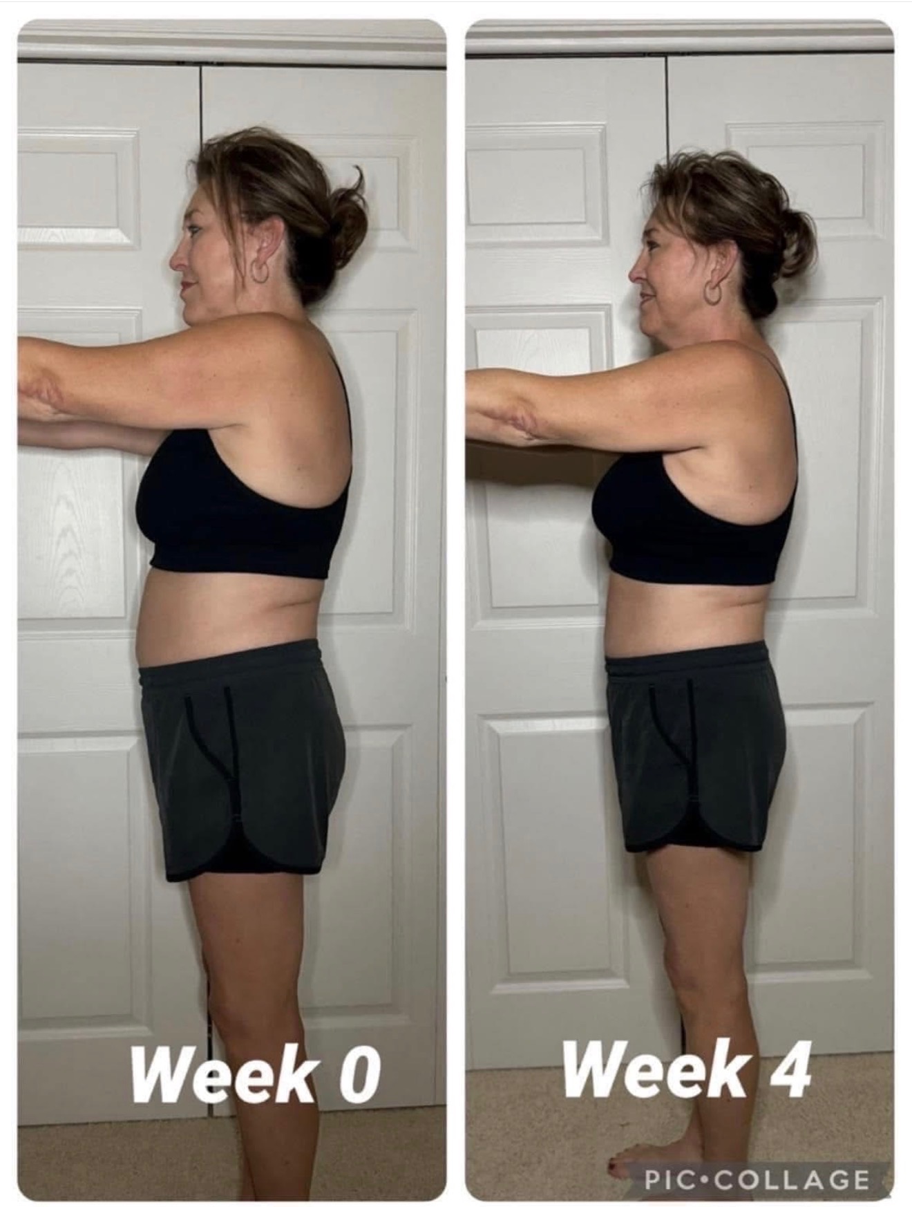 Side profile transformation from week 0 to week 4